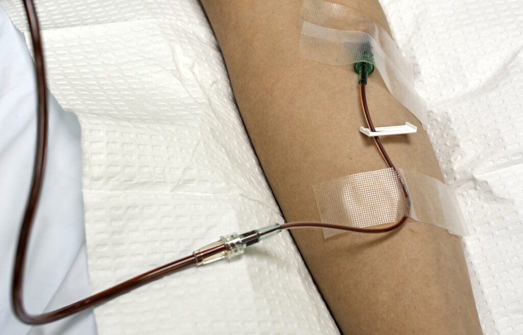 Ozone IV Therapy – Thriv Bio